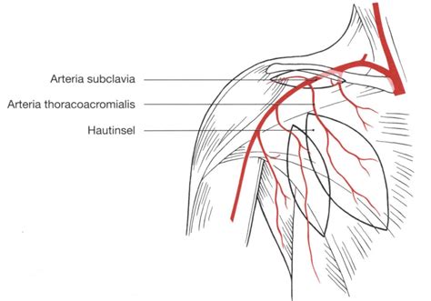 pectoralis major lappen|Pectoralis